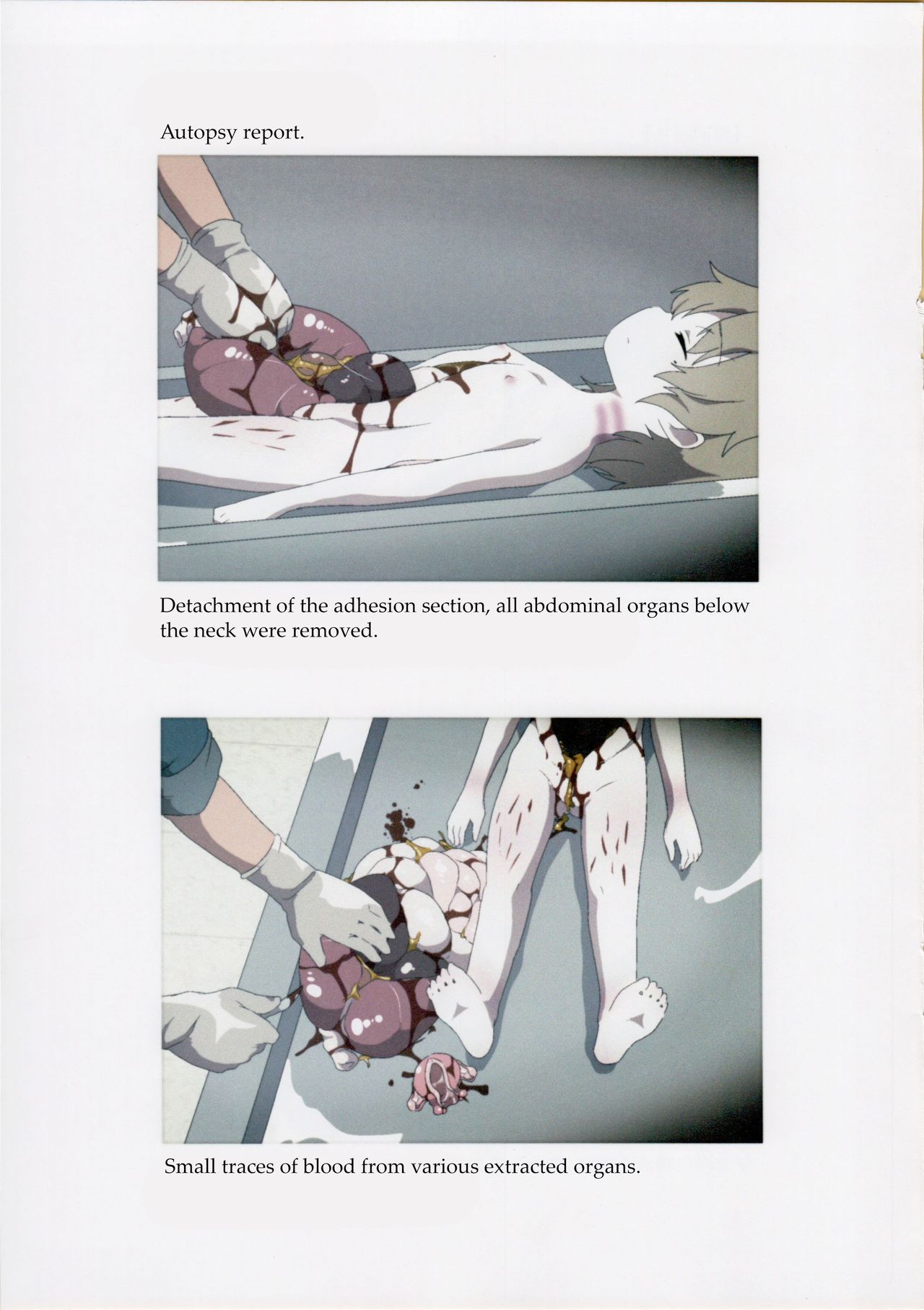 Nishiogikubo Shoujo Satsugai Jiken Shihou Kaibou Kiroku | Nishi-Ogikubo Girl Murder Case Judicial Autopsy Report page 8 full